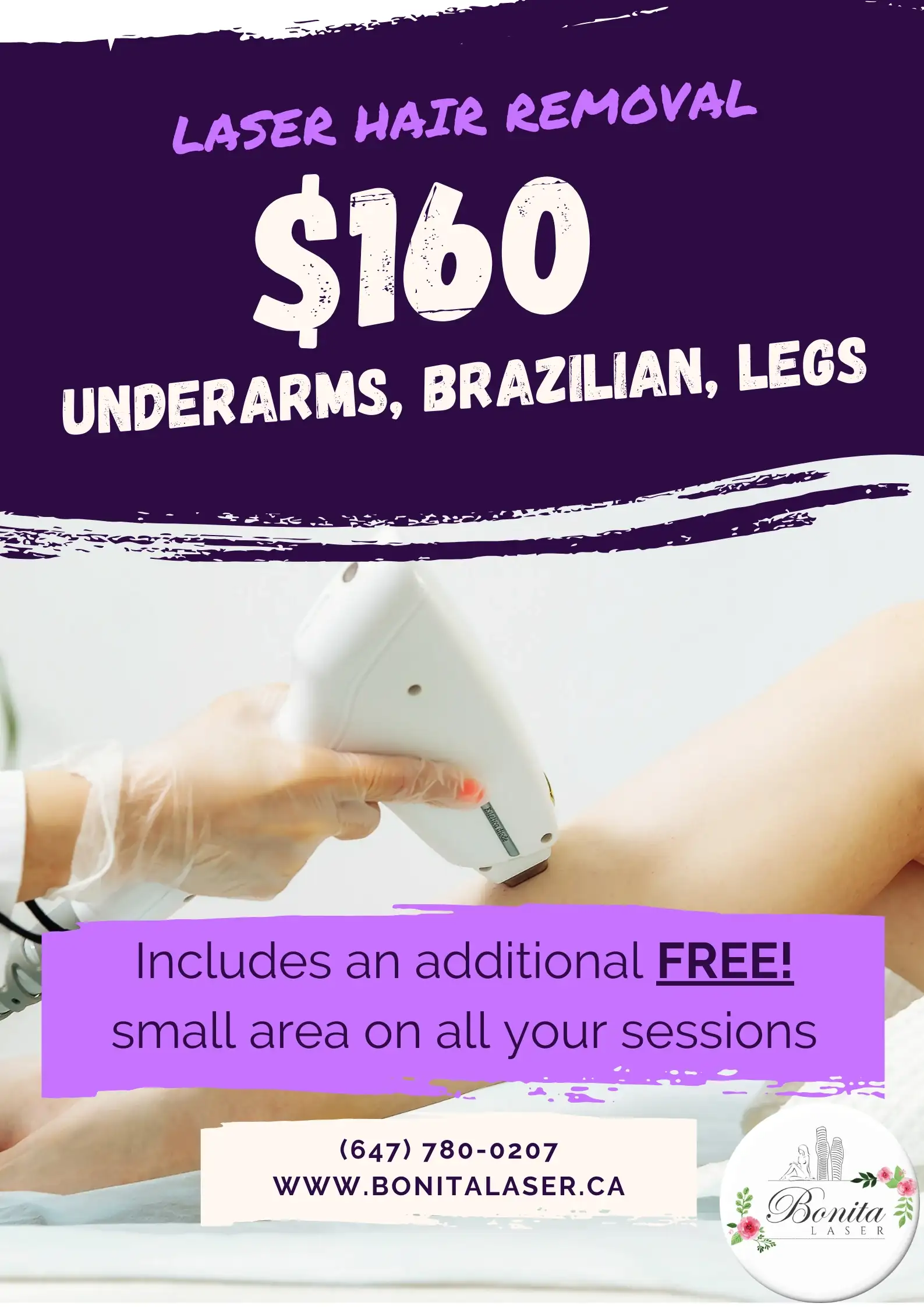 Laser hair removal promo: $160 for Underarms, Brazilian, and Legs at Bonita Laser with a free small area included.
